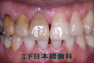 術前の状態